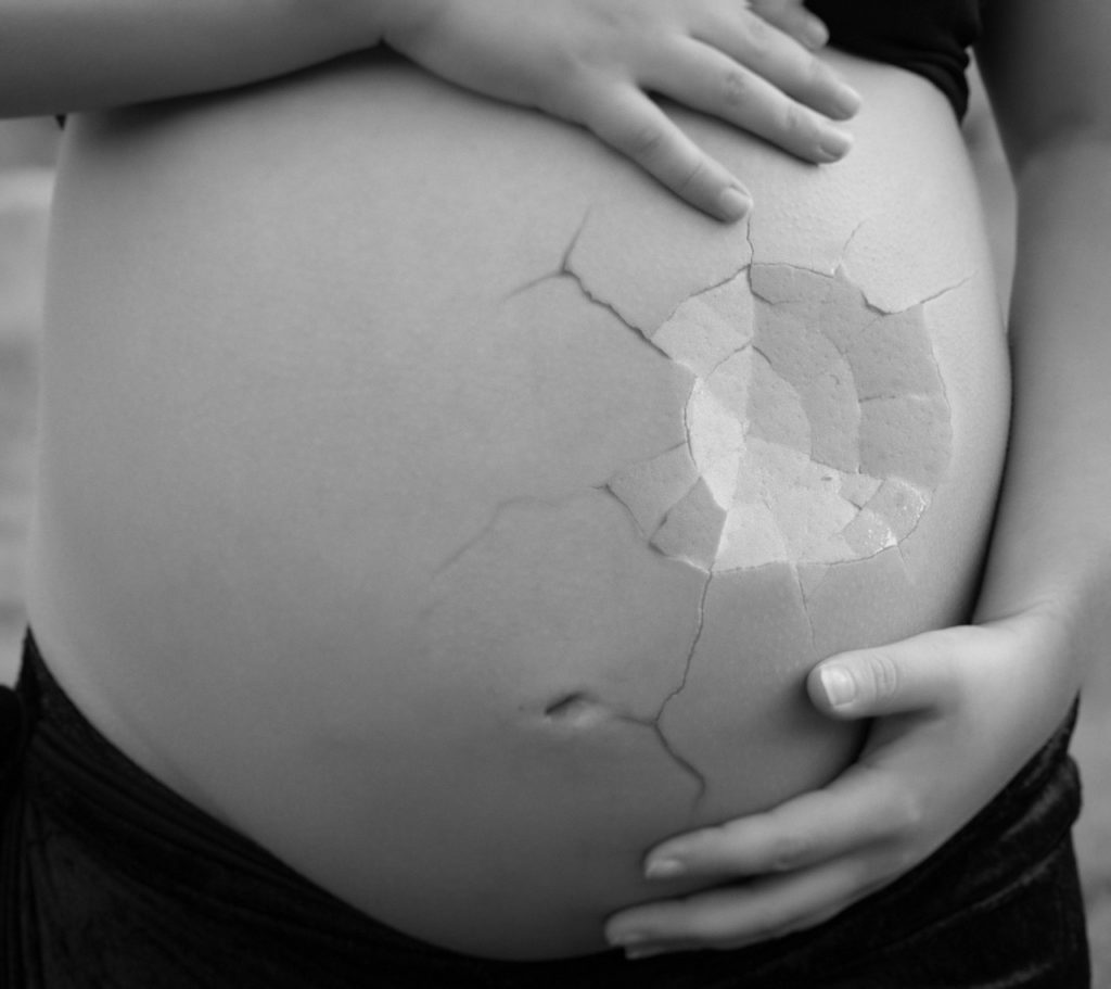 Woman's pregnant stomach cracked like an eggshell
